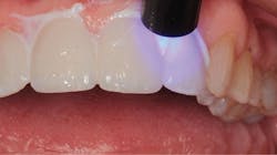 1711denas P10 1711denas P10