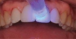 1711denas P12 1711denas P12