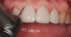 1711denas P13 1711denas P13