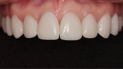 1711denas P14 1711denas P14