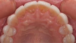 1711denas P15 1711denas P15