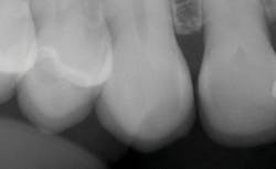 1711denas P16 1711denas P16