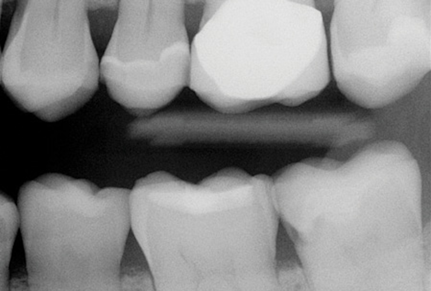 Diagnostic challenges of dental radiographs and adjunctive methods of