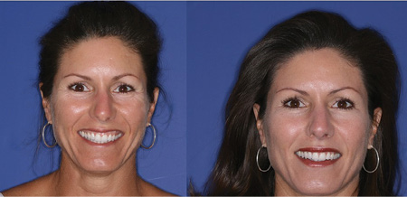 Content Dam De Print Articles Volume 107 Issue 11 1711demal P01