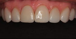 Content Dam De Print Articles Volume 107 Issue 11 1711denas P01 Content Dam De Print Articles Volume 107 Issue 11 1711denas P01