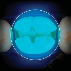 1712dekac P01 1712dekac P01