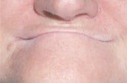 1803dechr P02 1803dechr P02