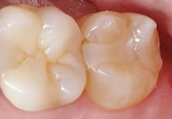 1803delow P01 1803delow P01