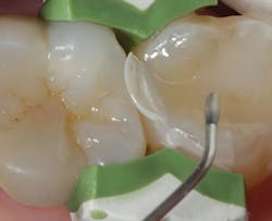 1803delow P04 1803delow P04