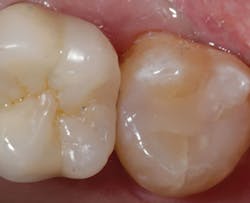 1803delow P05 1803delow P05