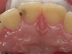 1804dekam P01 1804dekam P01