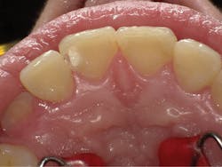 1804dekam P03 1804dekam P03