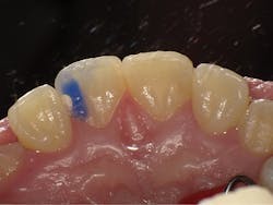 1804dekam P04 1804dekam P04