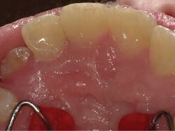 1804dekam P06 1804dekam P06