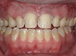 1804dekam P08 1804dekam P08