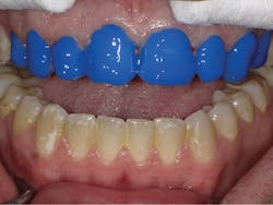 1804dekam P09 1804dekam P09