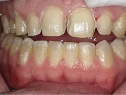 1804dekam P10 1804dekam P10