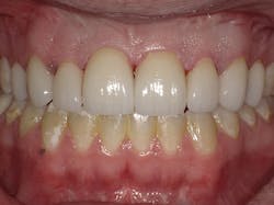 1804dekam P11 1804dekam P11