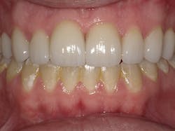 1804dekam P12 1804dekam P12