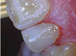 1804delow P01b 1804delow P01b