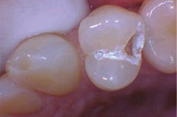 1804delow P02c 1804delow P02c