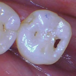 1804delow P03a 1804delow P03a