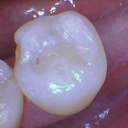 1804delow P03c 1804delow P03c