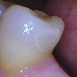 1804delow P03d 1804delow P03d