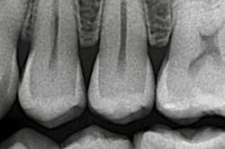 1804delow P04a 1804delow P04a