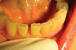 1804delow P05a 1804delow P05a