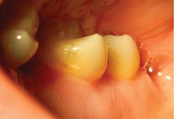 1804delow P06a 1804delow P06a