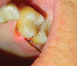 1804delow P06b 1804delow P06b