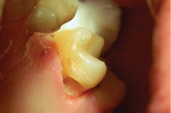 1804delow P06c 1804delow P06c