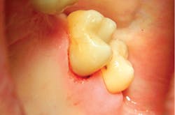 1804delow P06d 1804delow P06d