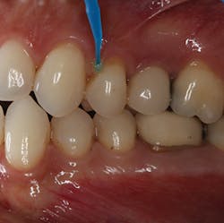 1804demar P01 1804demar P01