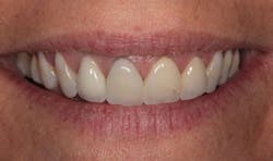 1804denas P01 1804denas P01