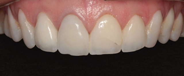 1804denas P02