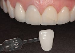 1804denas P03 1804denas P03