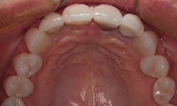 1804denas P04 1804denas P04