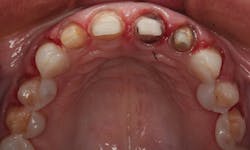 1804denas P05 1804denas P05