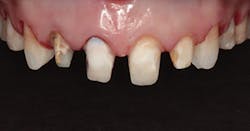 1804denas P06 1804denas P06