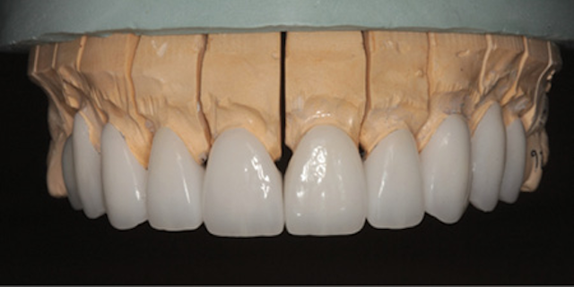 1804denas P07
