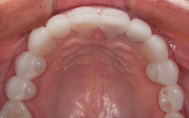1804denas P09