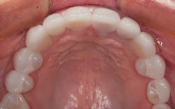 1804denas P09 1804denas P09