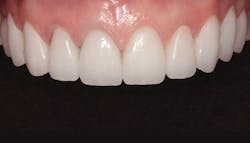 1804denas P10 1804denas P10