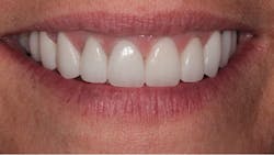 1804denas P11 1804denas P11