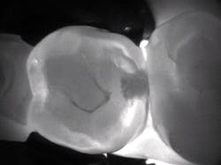 1804detom P02 1804detom P02