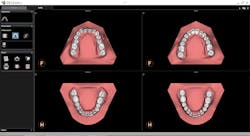 7 A Setup2dviewwithoutocclusiondisplay 7 A Setup2dviewwithoutocclusiondisplay