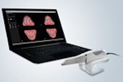 LaserFousWorld Test LaserFousWorld Test