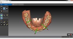 Green 2bguidance 2blower 2bocclusal Green 2bguidance 2blower 2bocclusal